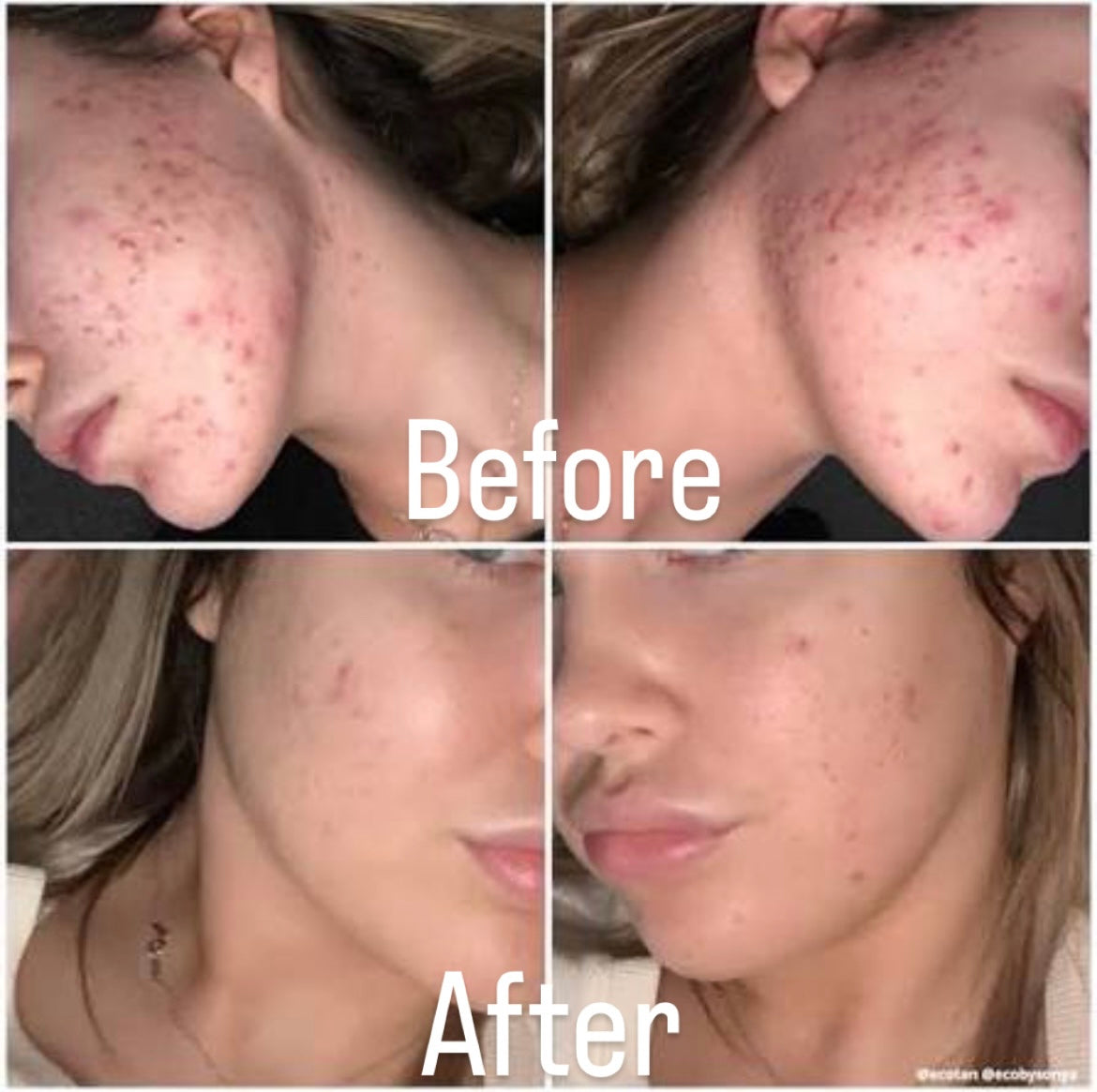 Auréva™– PDRN Pink Collagen Capsule Cream