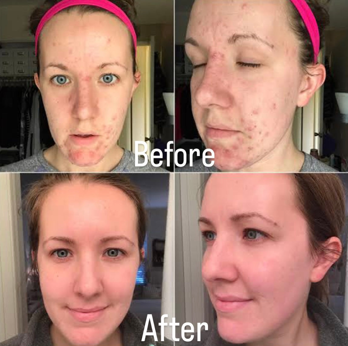 Auréva™– PDRN Pink Collagen Capsule Cream